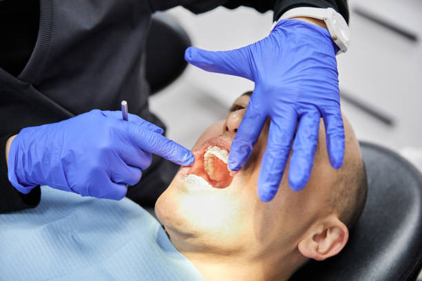 Best Emergency Dentist for Lost Fillings or Crowns in Pauls Valley, OK